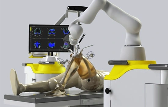 robotic-total-knee-replacement-surgery
